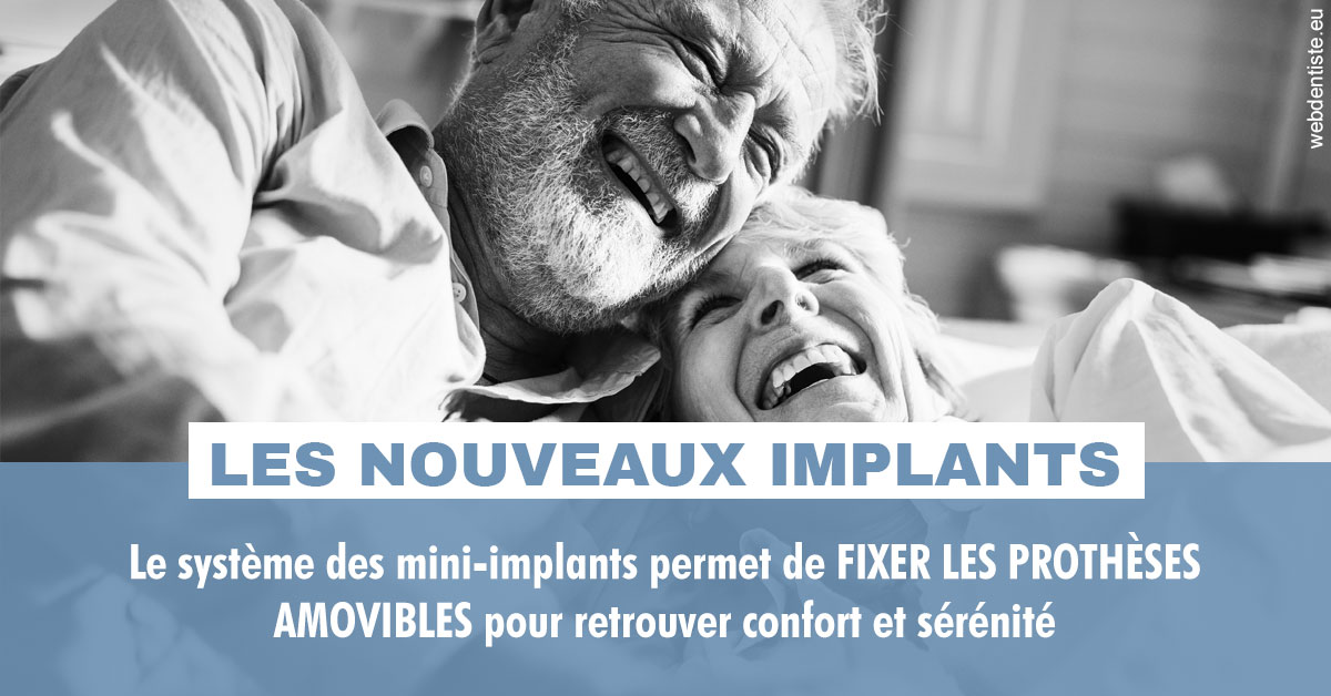 https://dr-lacaille-dominique.chirurgiens-dentistes.fr/Les nouveaux implants 2