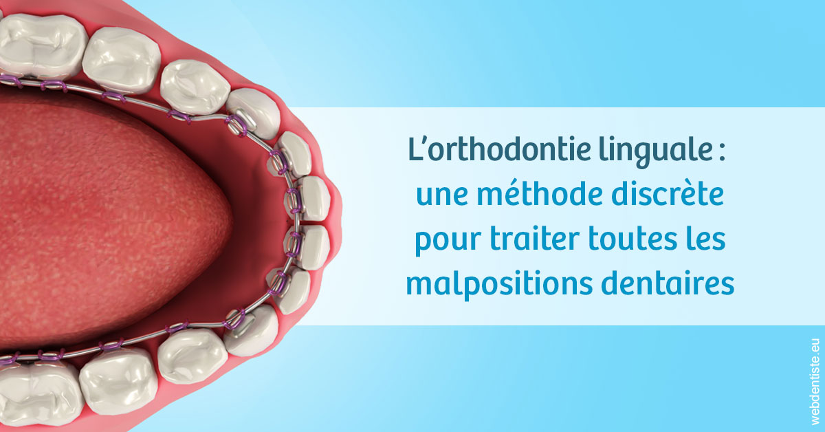 https://dr-lacaille-dominique.chirurgiens-dentistes.fr/L'orthodontie linguale 1