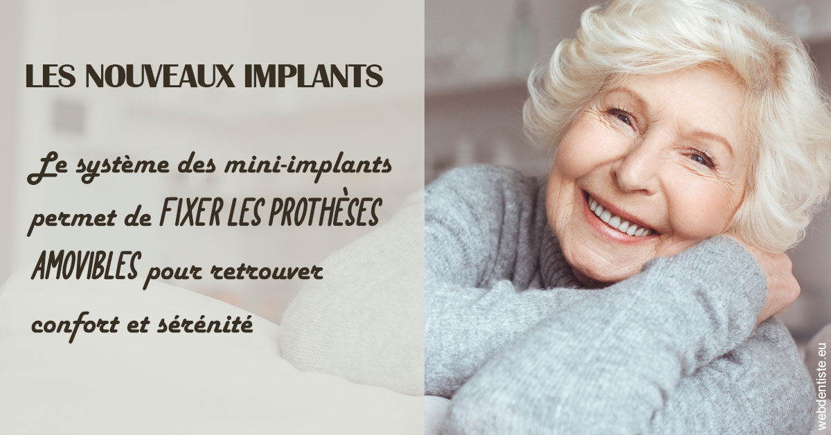https://dr-lacaille-dominique.chirurgiens-dentistes.fr/Les nouveaux implants 1