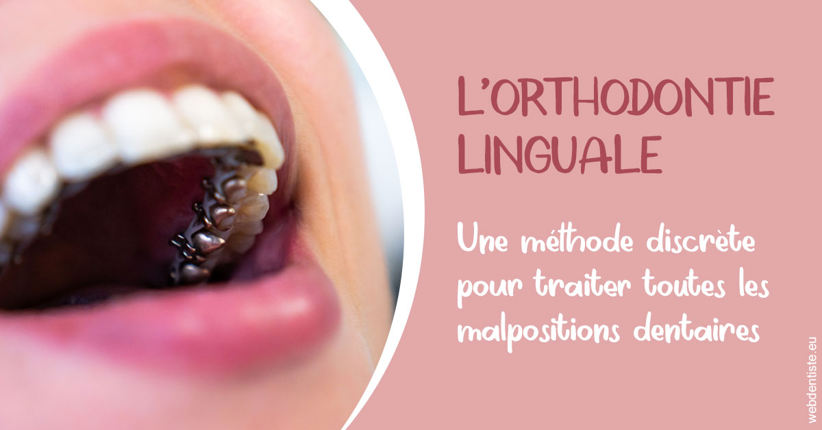 https://dr-lacaille-dominique.chirurgiens-dentistes.fr/L'orthodontie linguale 2