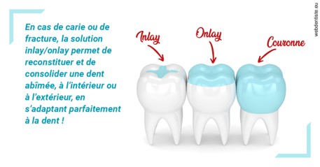 https://dr-lacaille-dominique.chirurgiens-dentistes.fr/L'INLAY ou l'ONLAY