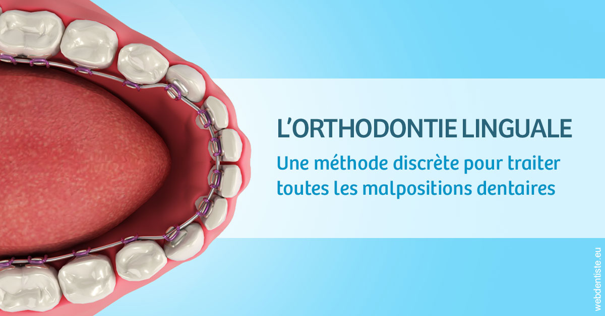 https://dr-lacaille-dominique.chirurgiens-dentistes.fr/L'orthodontie linguale 1