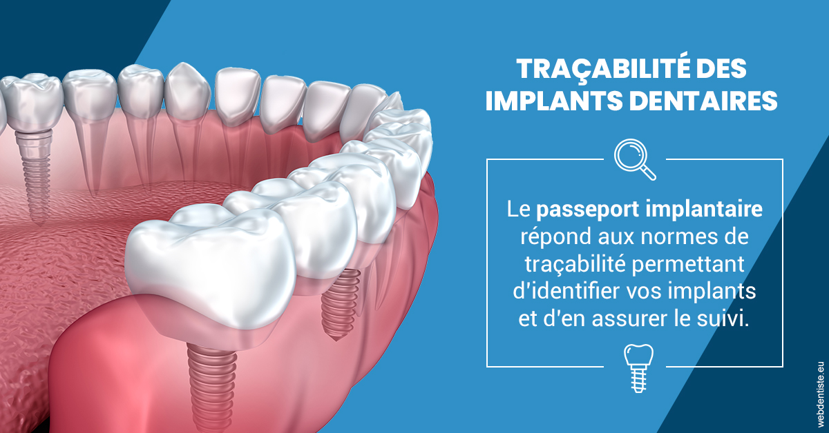 https://dr-lacaille-dominique.chirurgiens-dentistes.fr/T2 2023 - Traçabilité des implants 1
