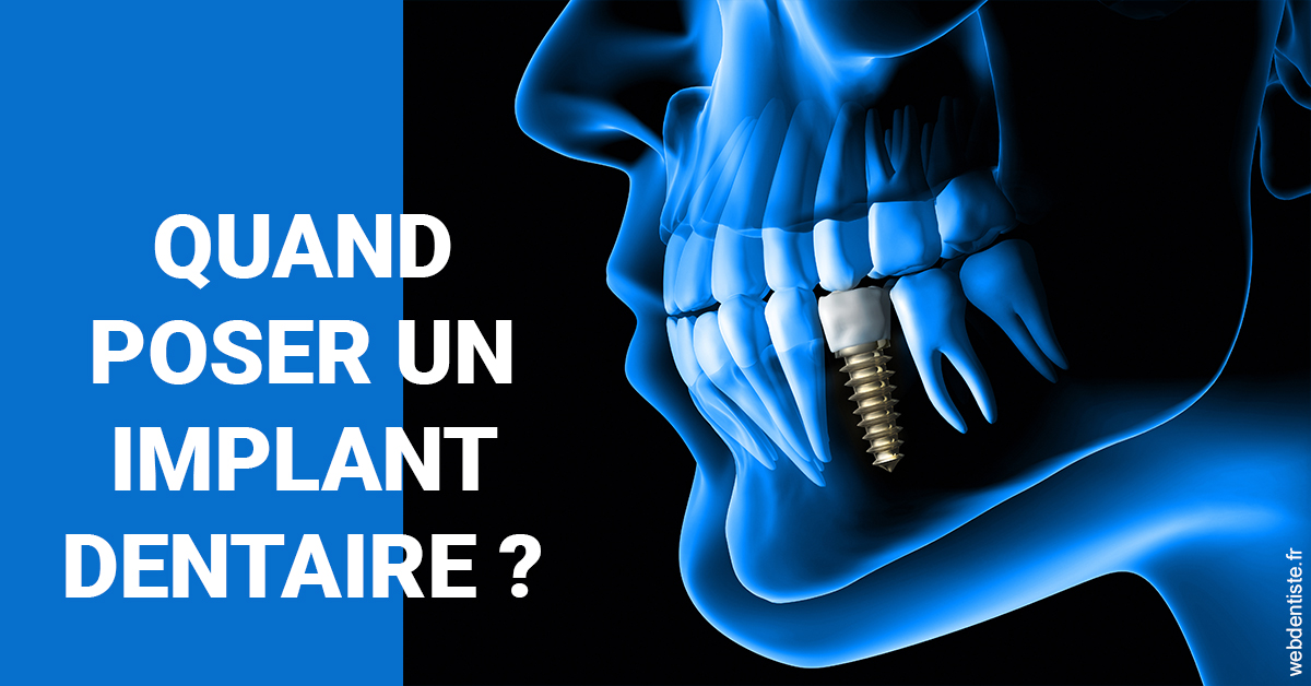https://dr-lacaille-dominique.chirurgiens-dentistes.fr/Les implants 1