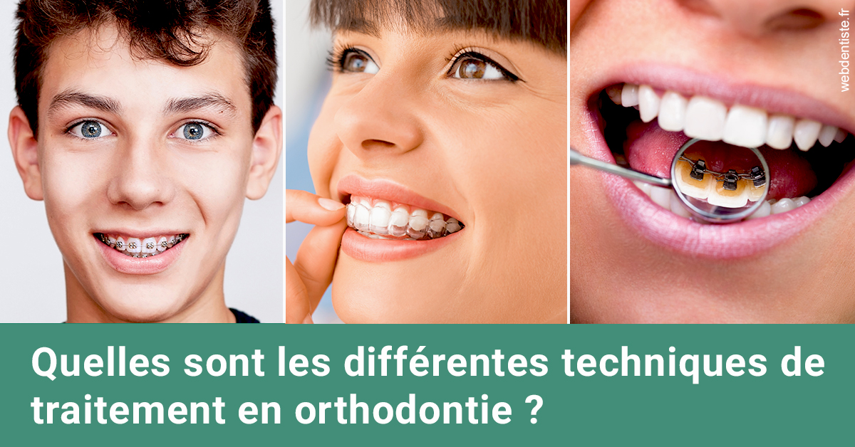 https://dr-lacaille-dominique.chirurgiens-dentistes.fr/Les différentes techniques de traitement 2