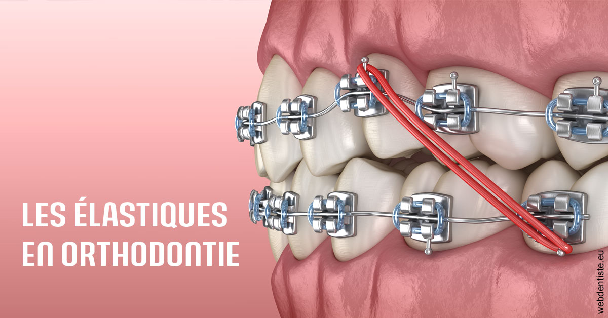 https://dr-lacaille-dominique.chirurgiens-dentistes.fr/Elastiques orthodontie 2