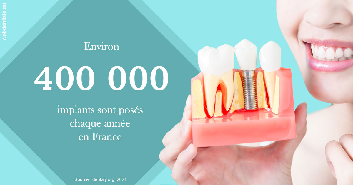 https://dr-lacaille-dominique.chirurgiens-dentistes.fr/Pose d'implants en France 2